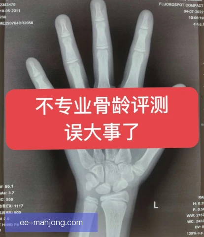 单板滑雪骨龄评估应用，青少年选材与伤病预防升级